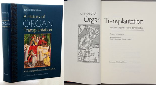 A HISTORY OF ORGAN TRANSPLANTATION.